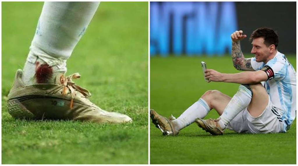 Messi chơi trận chung kết Copa America với chấn thương gân khoeo