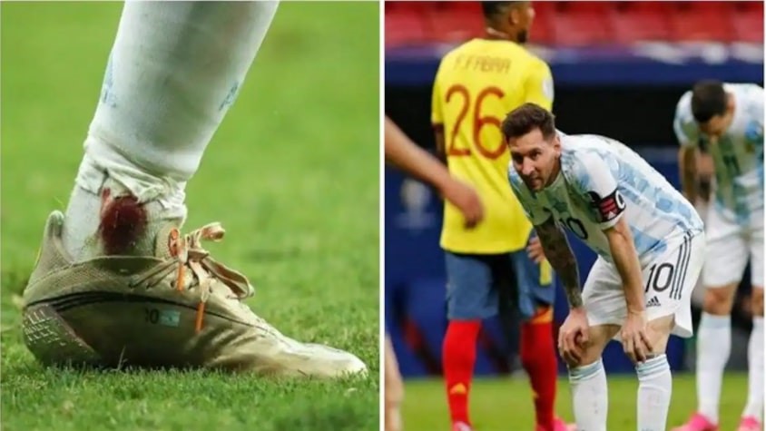 Xót xa hình ảnh Messi nén đau thi đấu với bên chân chảy máu